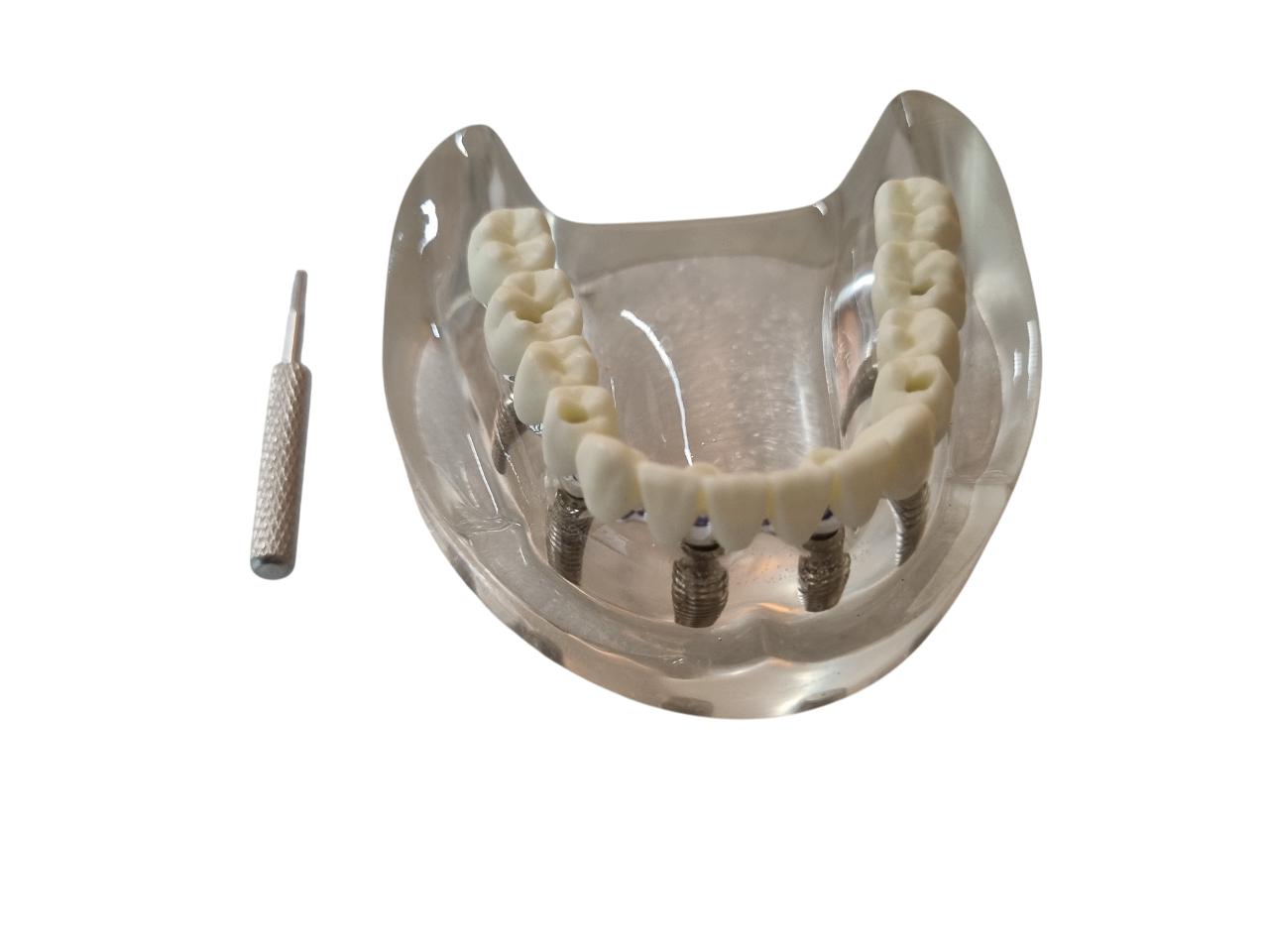 Julldent 181 All on 4 Paulo Malo Model with Prosthesis