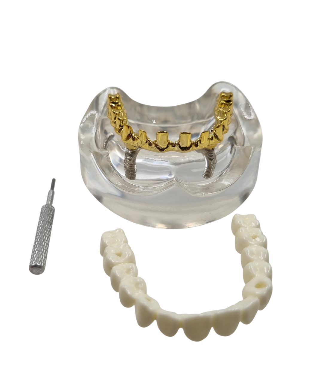 Julldent 181 All on 4 Paulo Malo Model with Prosthesis - Image 5