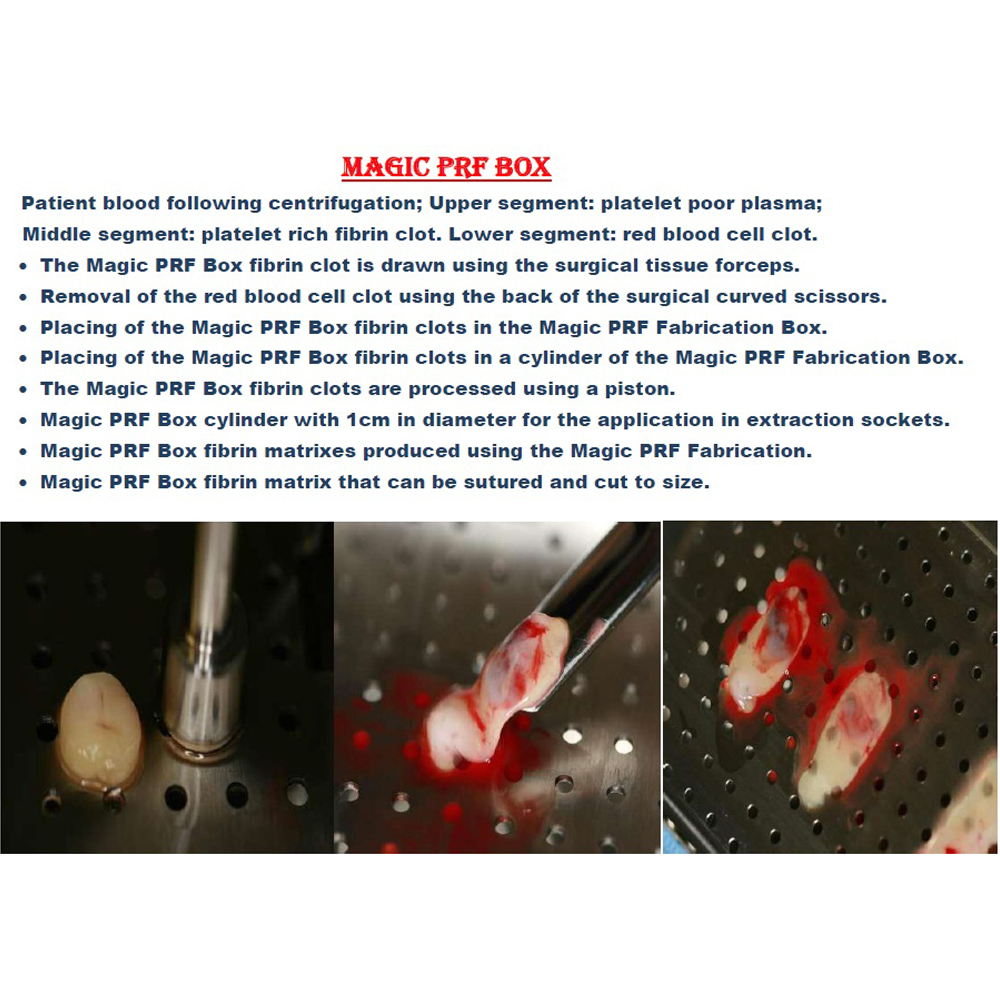 Julldent 051 PRF Box with Membrane Tweezer - Image 2