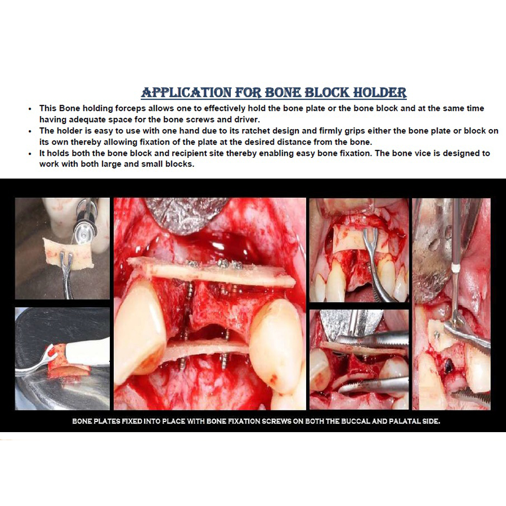 Julldent 059 GBR Forceps / Bone Block Holder - Image 2