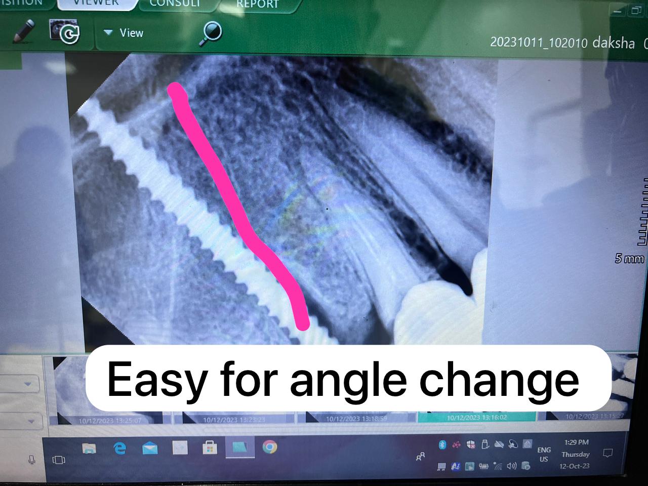 Julldent 169 Pterygoid Path Finder ILM Tool - Image 8