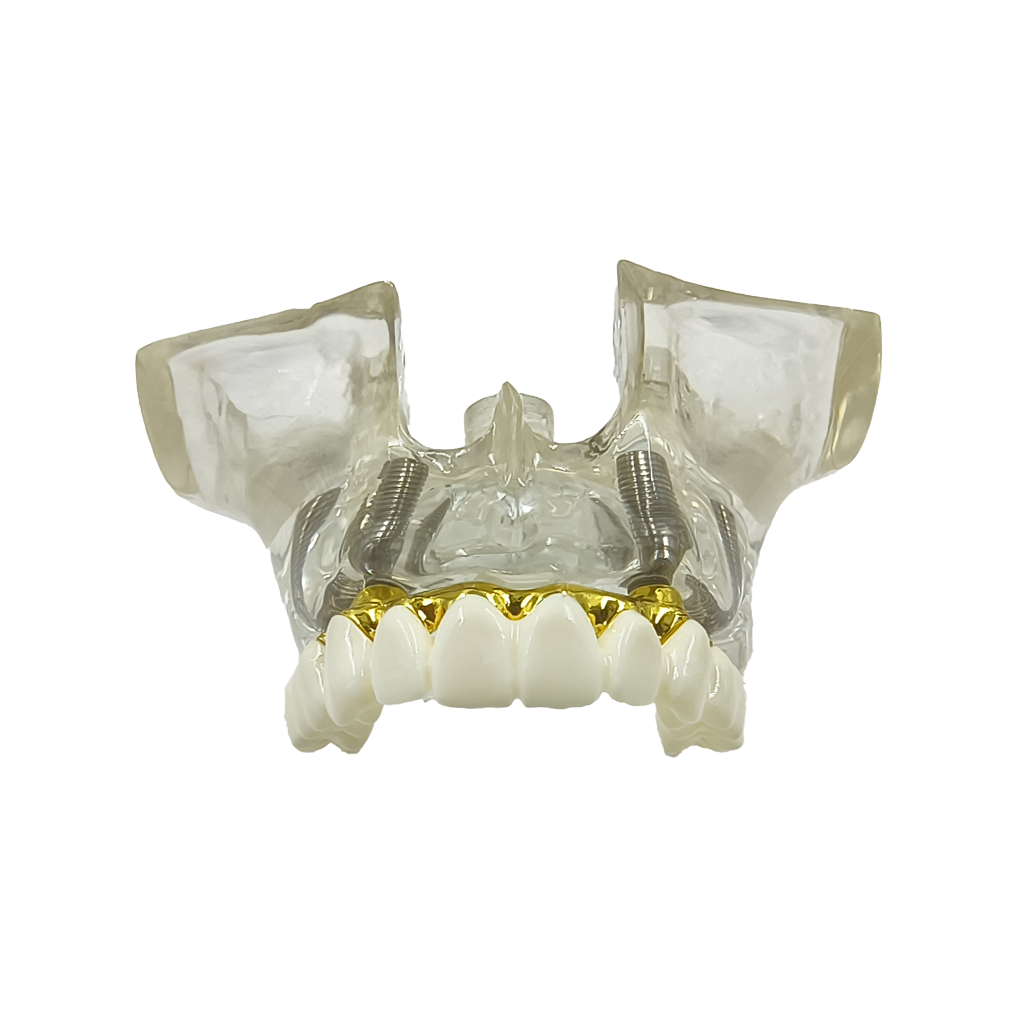 Julldent 205 Upper Jaw Model