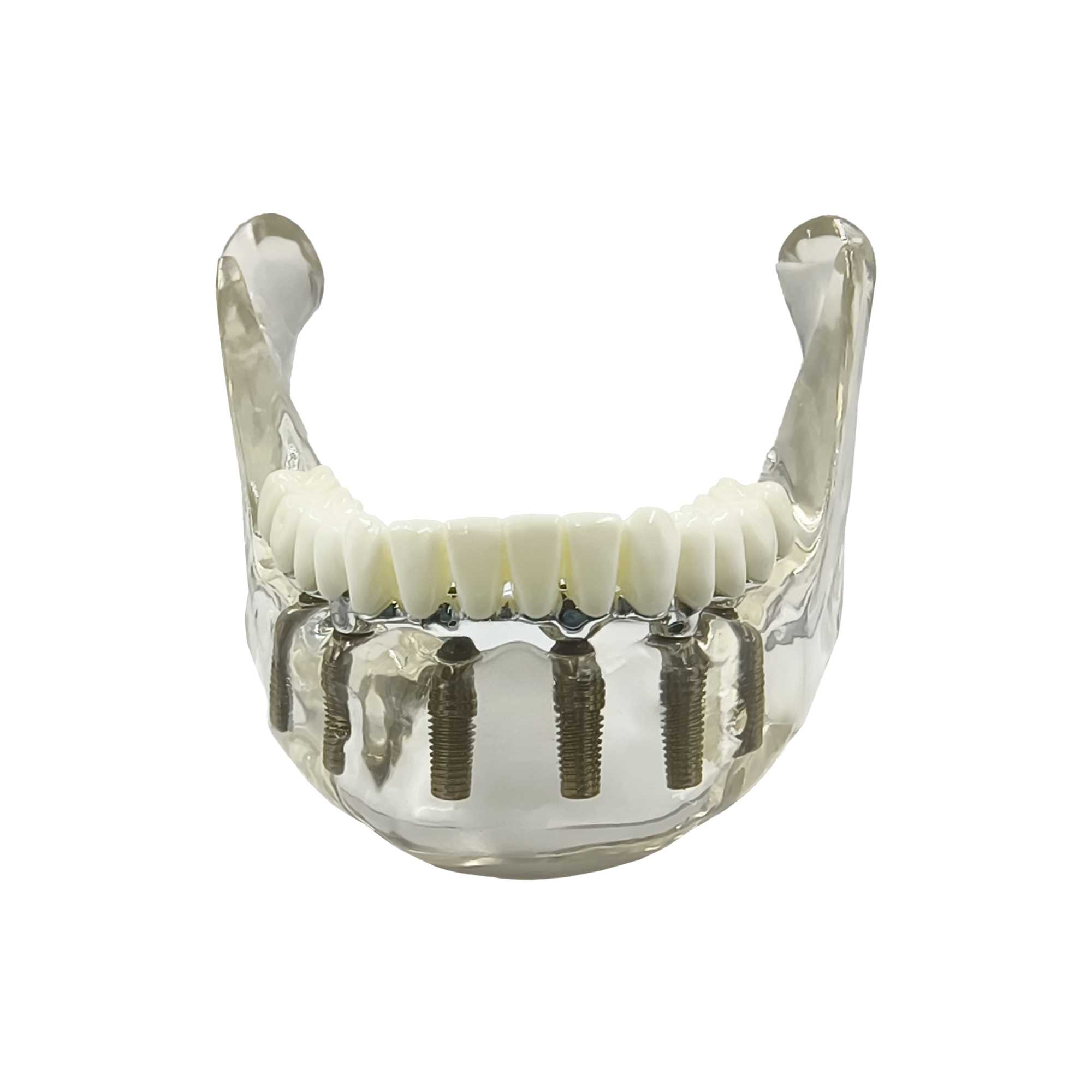 Julldent 208 Lower Jaw Model