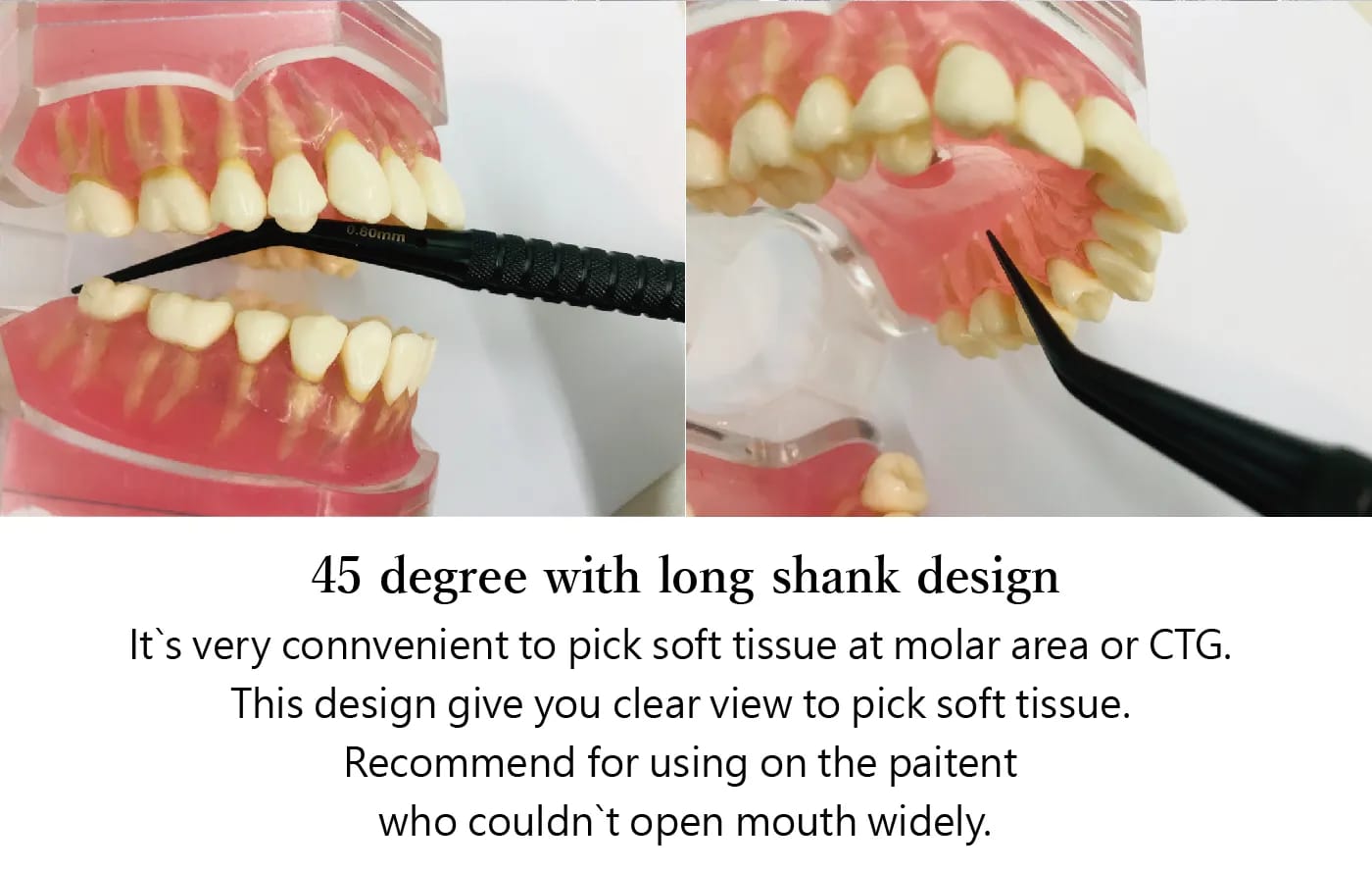 Julldent 041 Micro Surgical Forceps - Image 2