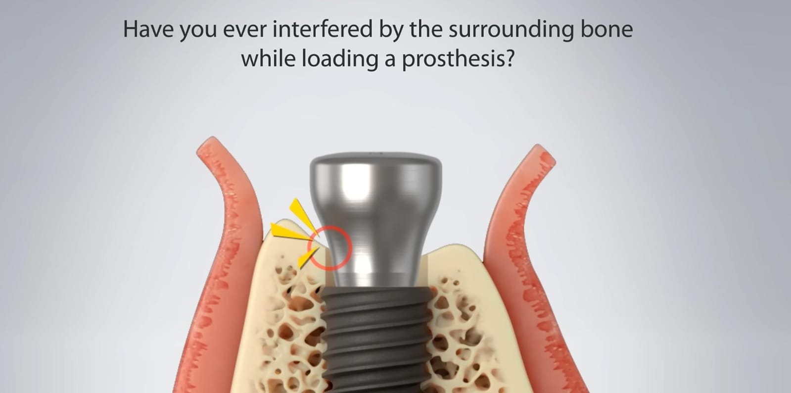 Julldent 016 Profile Drill 6mm - Image 3