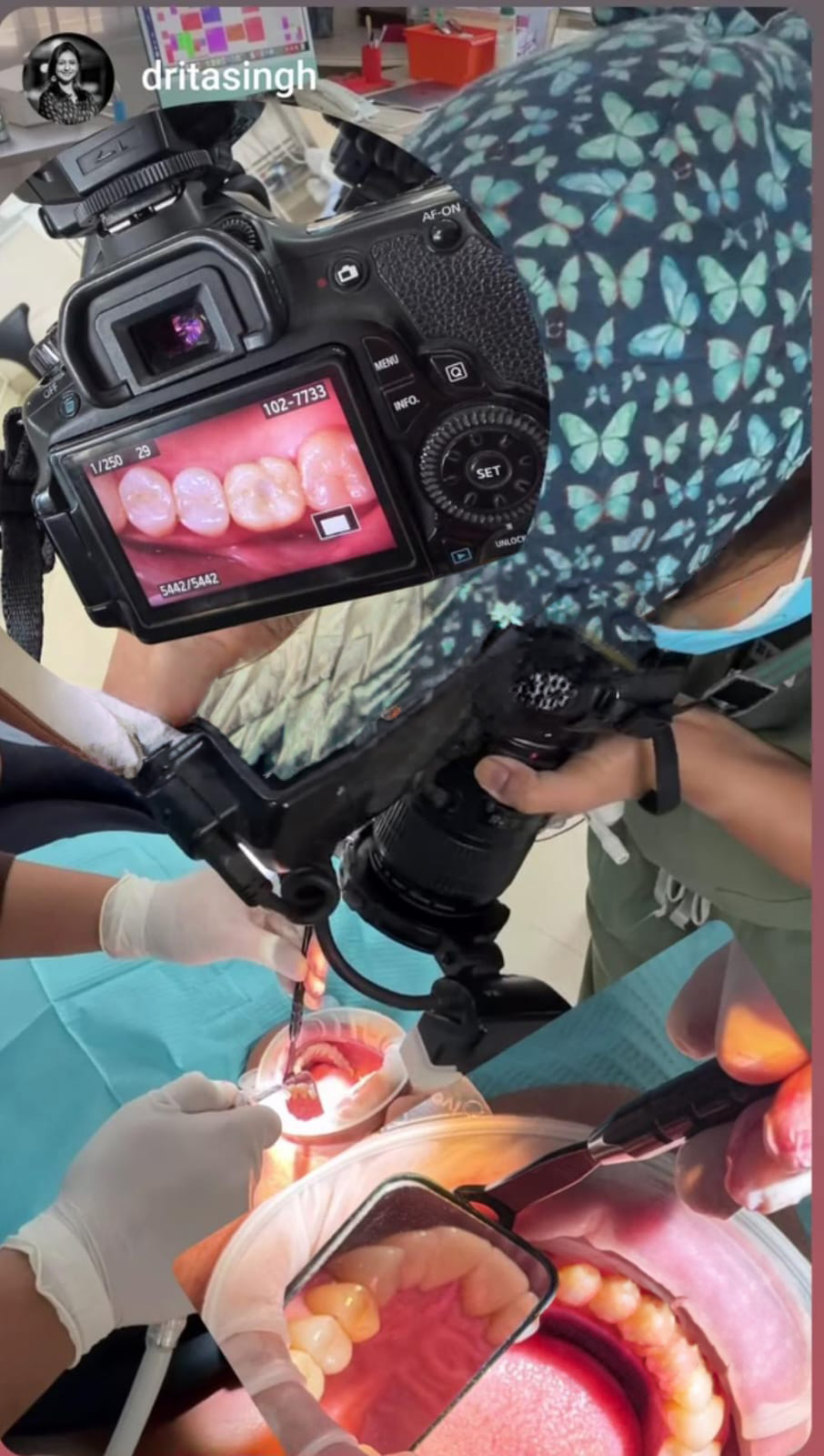 Julldent 198 Rhodium Mirror for Dental Photography - Image 2