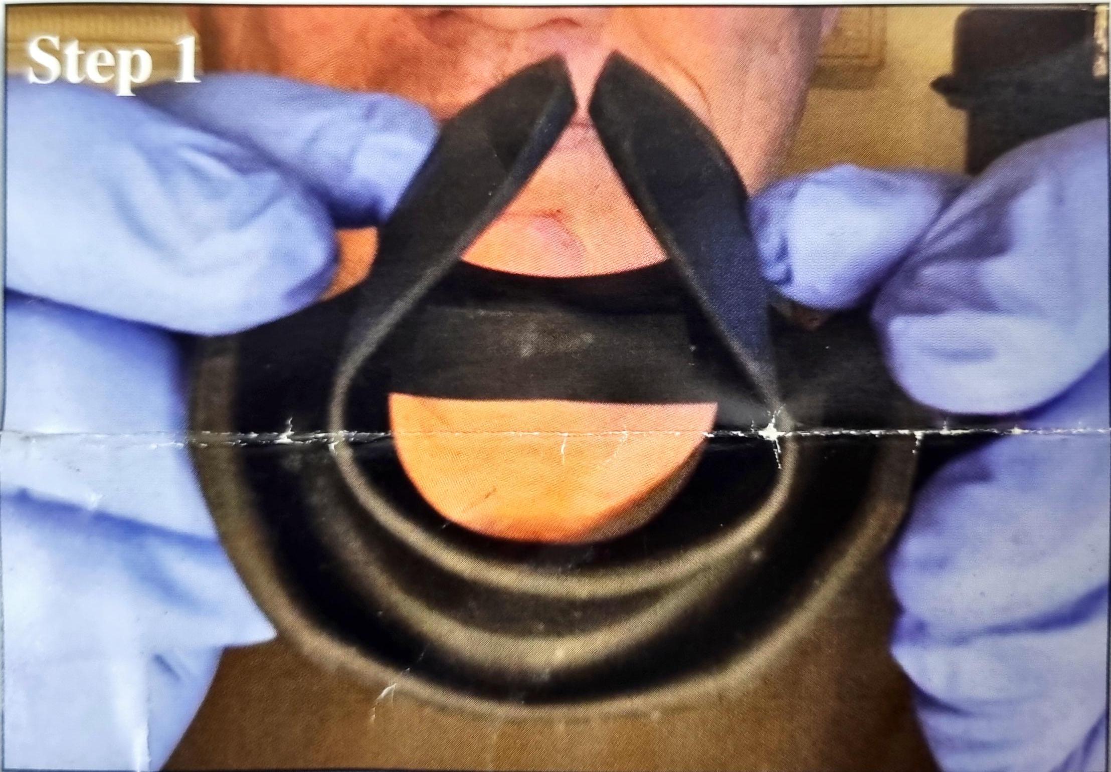 Julldent 144 Insta Retractor - Image 5