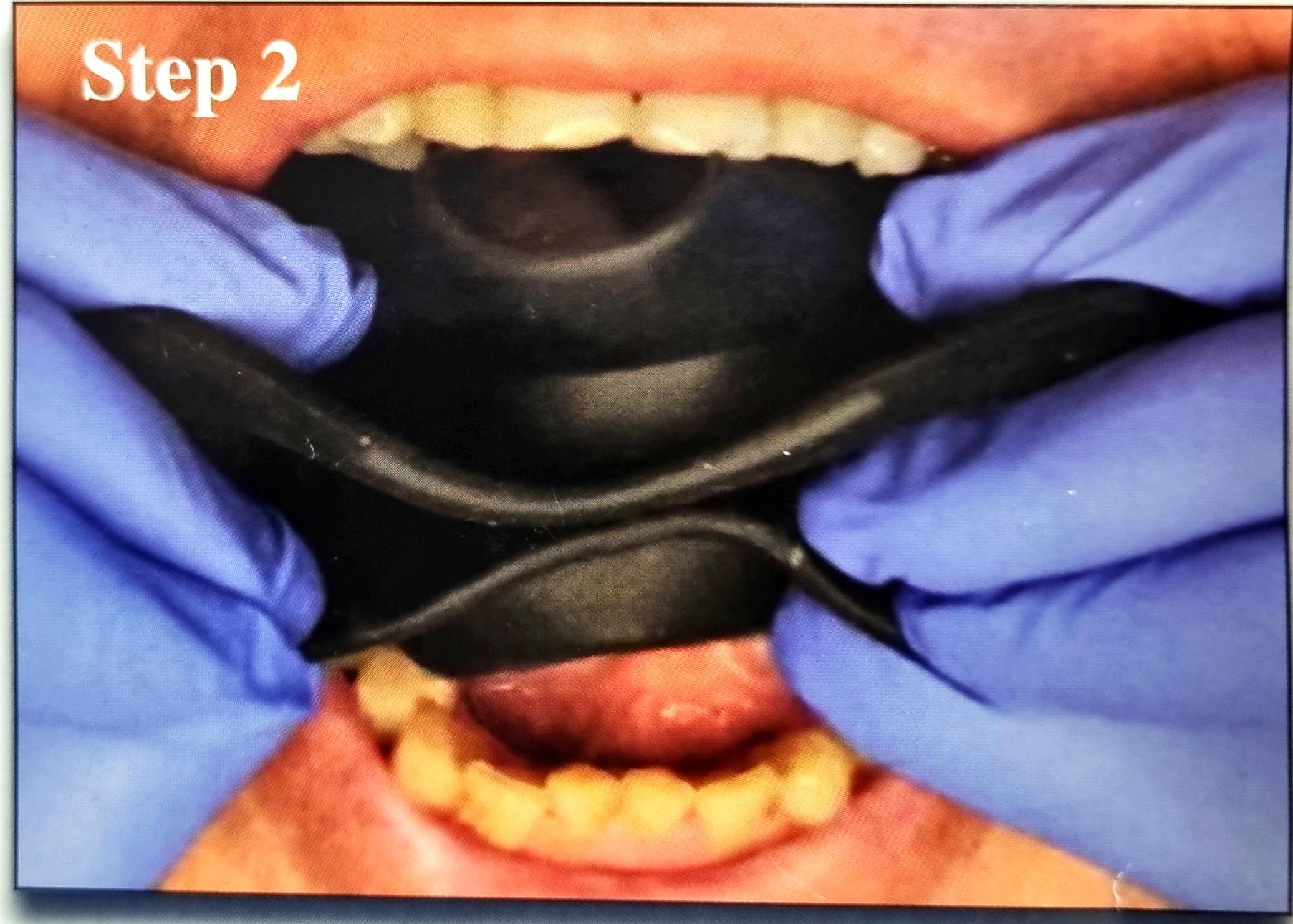 Julldent 144 Insta Retractor - Image 6