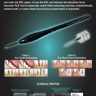 Flexible Periodontal Ligament Displacer (PLD Tool)