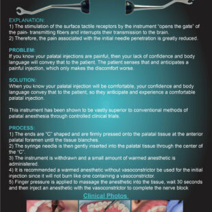PALATAL ANESTHESIA TOOL (PAT)
