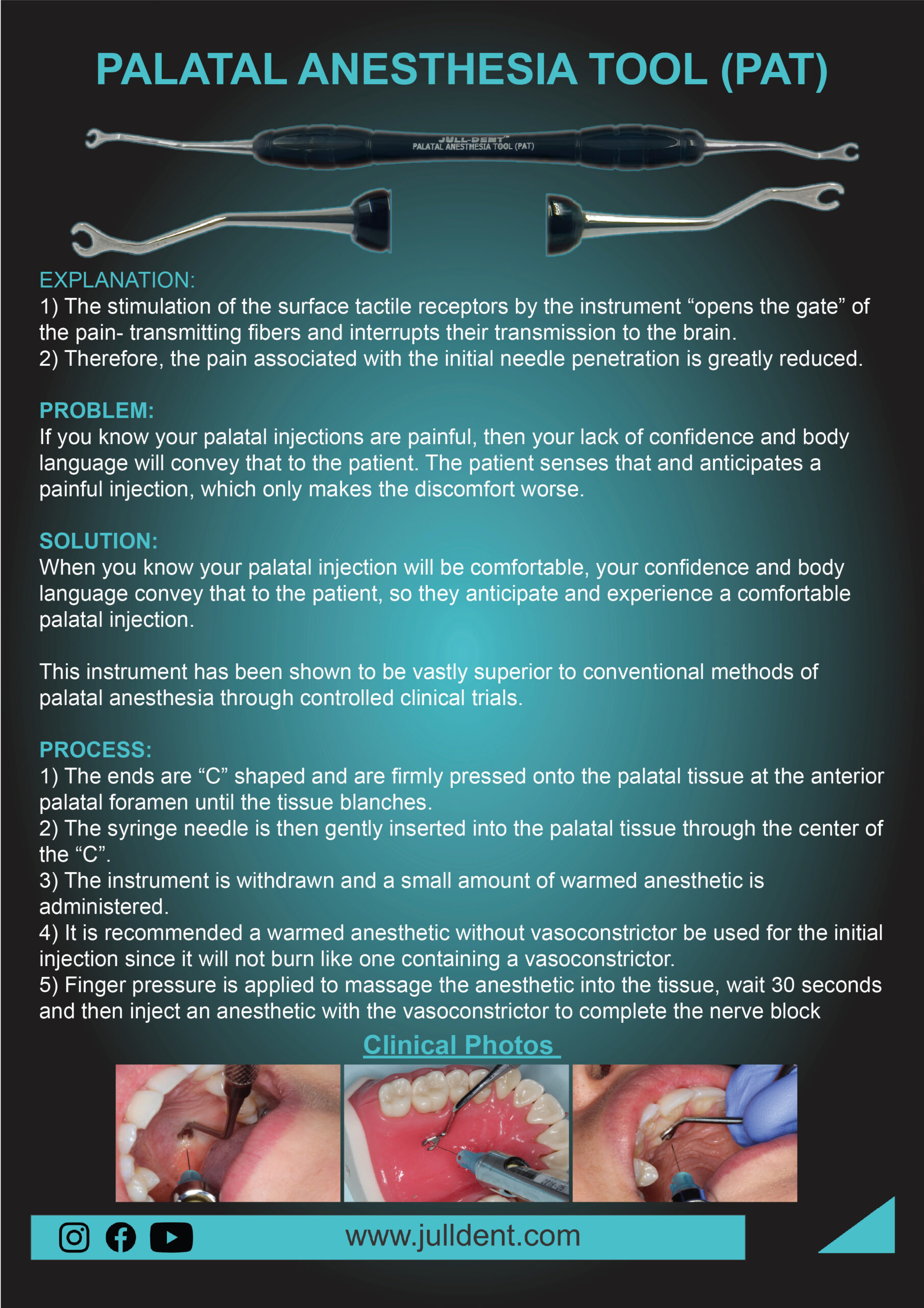 PALATAL ANESTHESIA TOOL (PAT)
