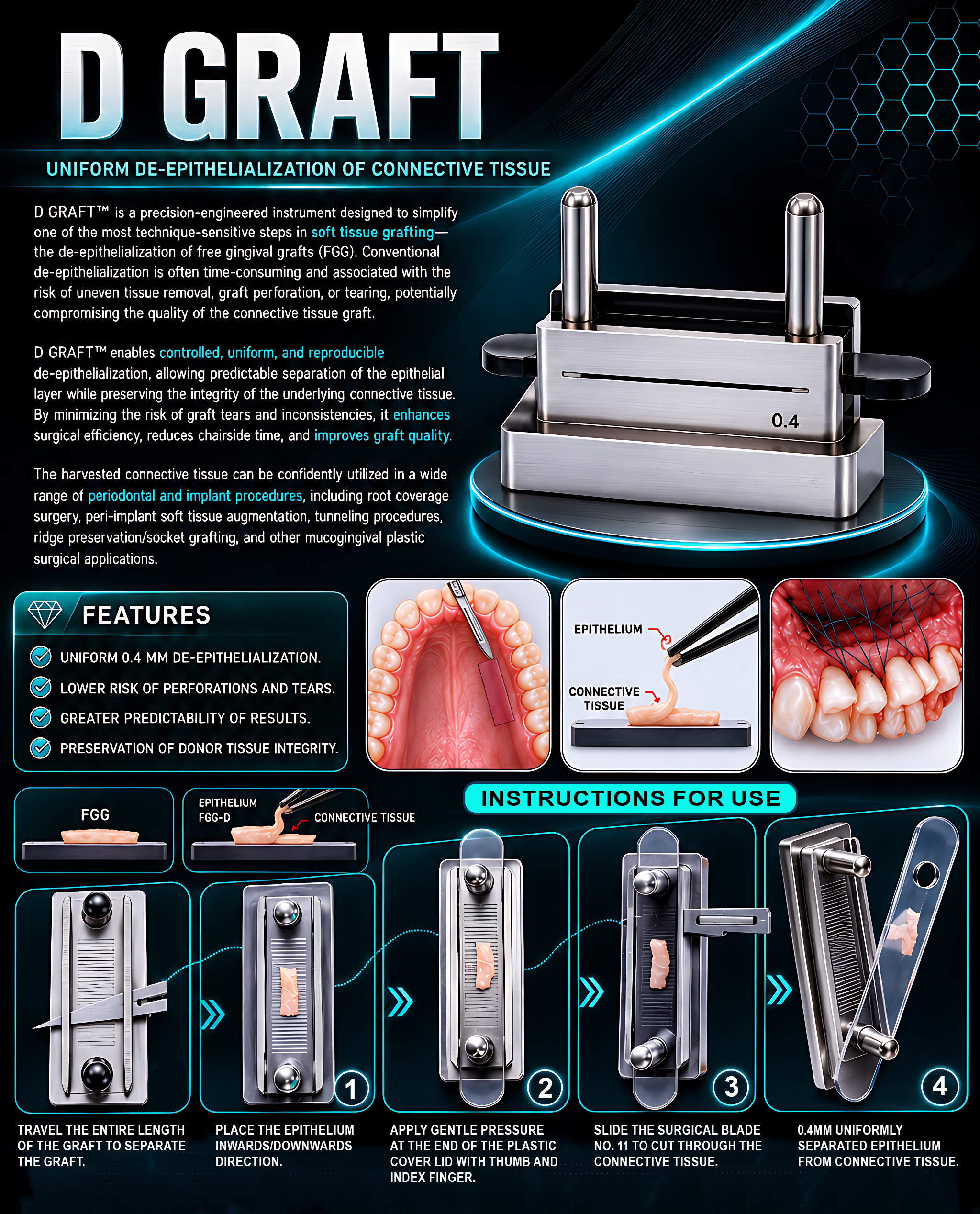 JullDent 247 D Graft