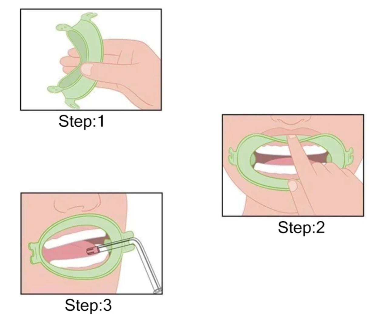 JullDent 249 Flexi-Ring Autoclavable Retractor - Image 3