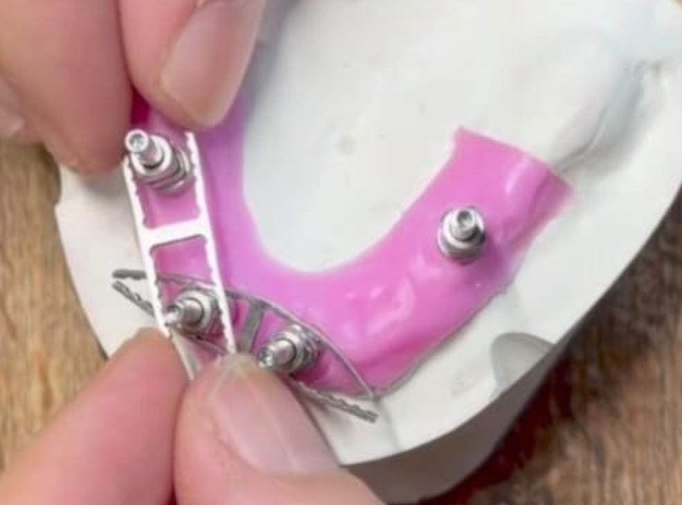 JullDent 251 Jig Ladder Clips (Set of 9 clips) - Image 5